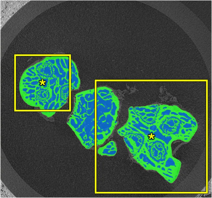Bone Appétit: 2D Software for Deep Learning Bone Segmentation