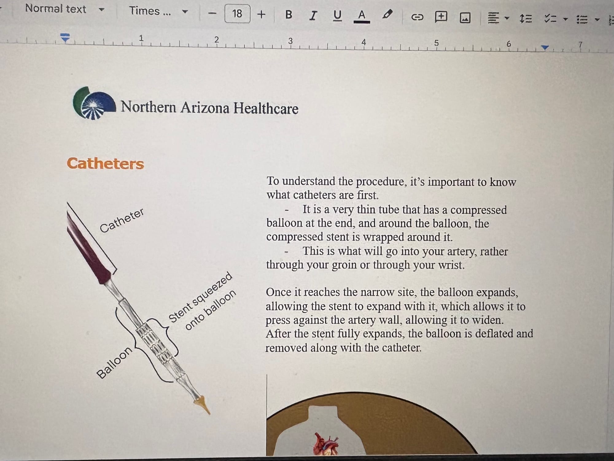 Week 3: Catheters, Catheters, and more Catheters