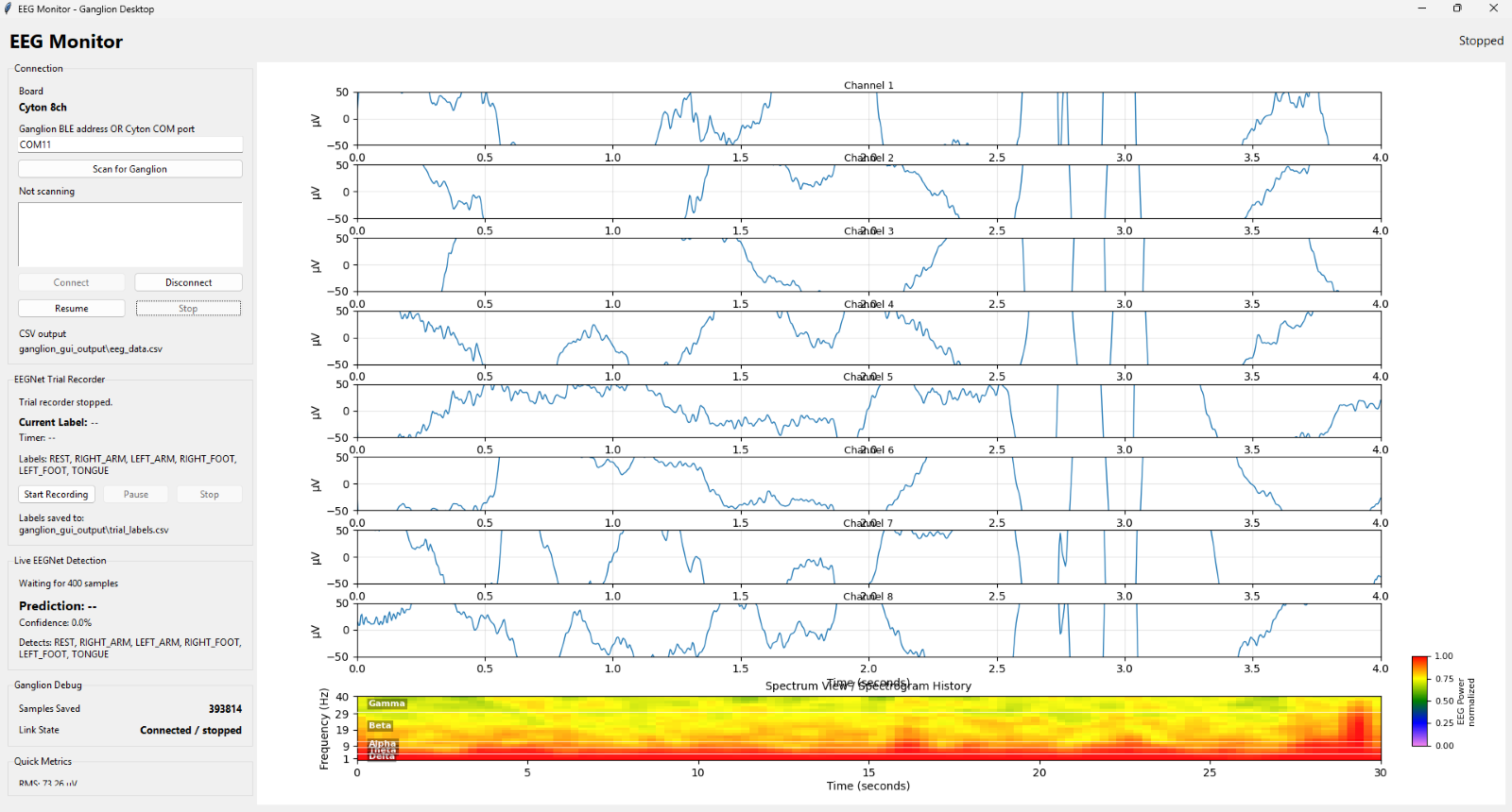 End Program Eeg Week 9: More Channels Toward Success